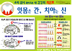 옵티마케어, 6월부터 잇몸질환 이벤트