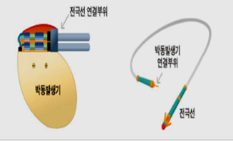 삼성서울병원, 인공심장박동기 1000례 달성