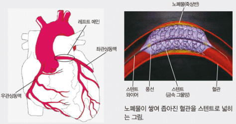 아산병원 박승정 원장, 'NEJM' 4번째 게재