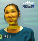 원진성형외과·치과, 얼굴 은폐 '화성인' 돕는다