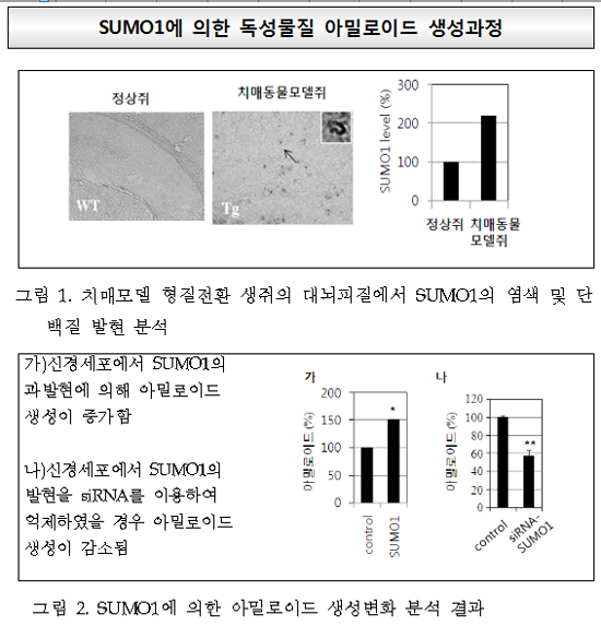국내 연구진, 알츠하이머 치매 유도 새 유전자 발견