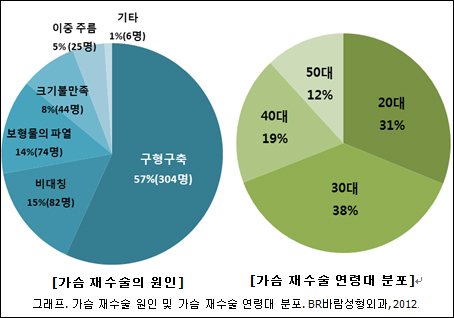 가슴확대 재수술 환자 10명 중 6명 구형구축이 원인