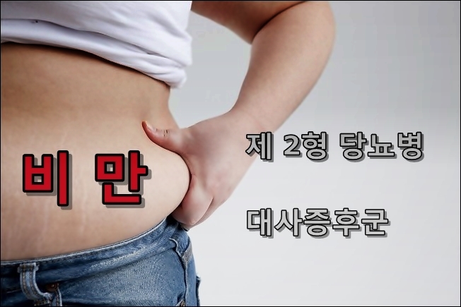 "글리타존, 비만·대사증후군 두마리 토끼 잡아"  