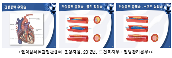 심장 관상동맥우회술 질 개선…사망률·재수술률 감소