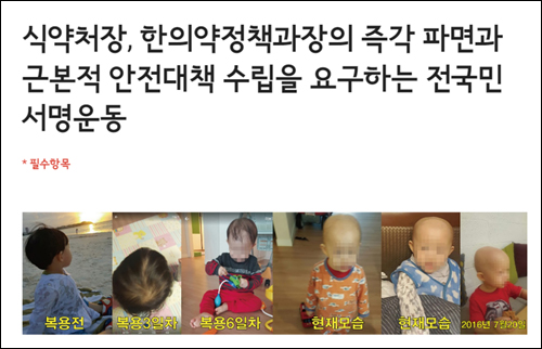 탈모 환아 논란에 소청과 의사들 서명운동