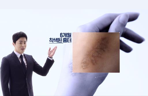더마틱스 울트라, 새 TV 광고 선보여