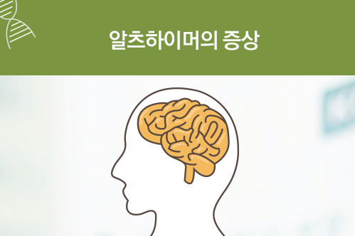 해결해야 할 숙제, 퇴행성 뇌질환 '알츠하이머'