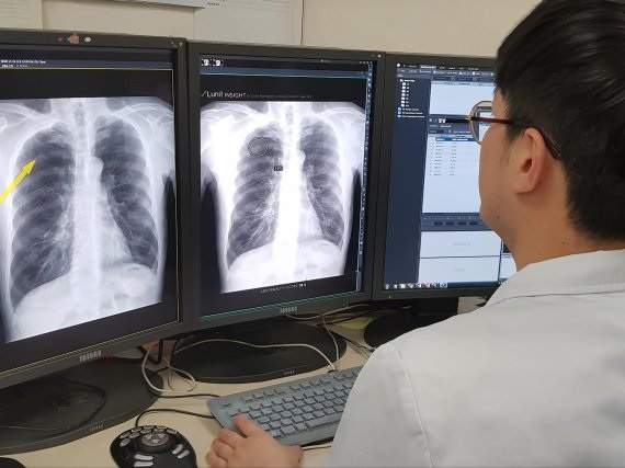 서울대병원, AI로 폐암 조기진단...정확도 97%