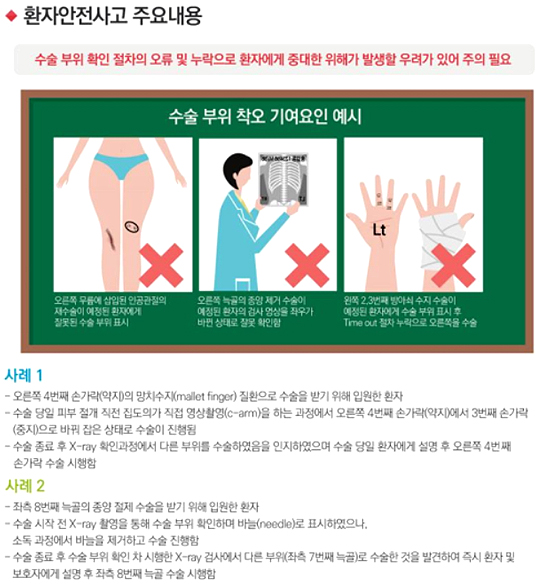 부위 확인 없이 엉뚱한 곳 수술…환자안전 주의보