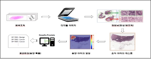 AI 기술 적용된 전립선암 진단 소프트웨어 품목허가 