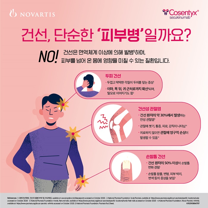 노바티스, '건선의 날' 맞아 인포그래픽 공개…"전신에 영향"
