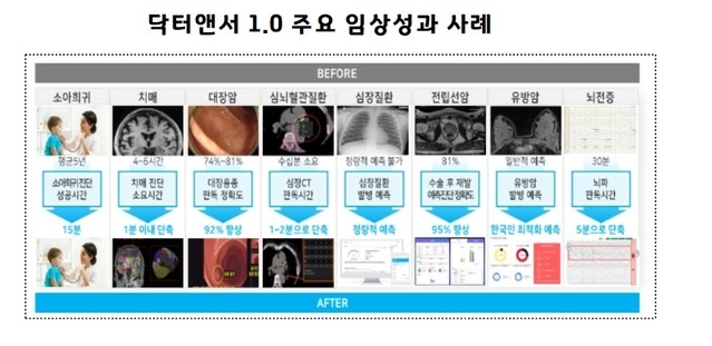 AI가 폐렴·고혈압 진단…정부 "닥터앤서 2.0 개발 시작"