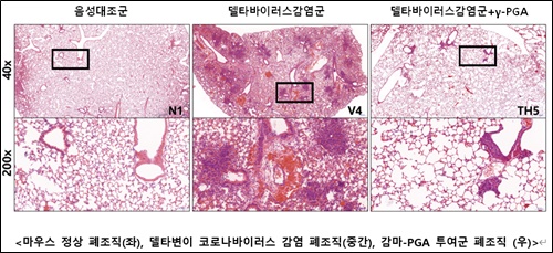 바이오리더스, 먹는 코로나치료제 개발 속도