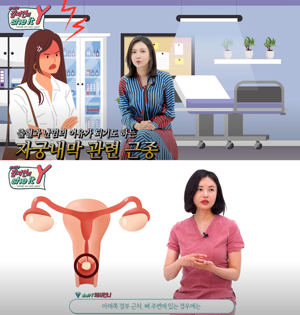 생리통·골반통, '자궁근종' 의심해야…비수술 치료 가능 