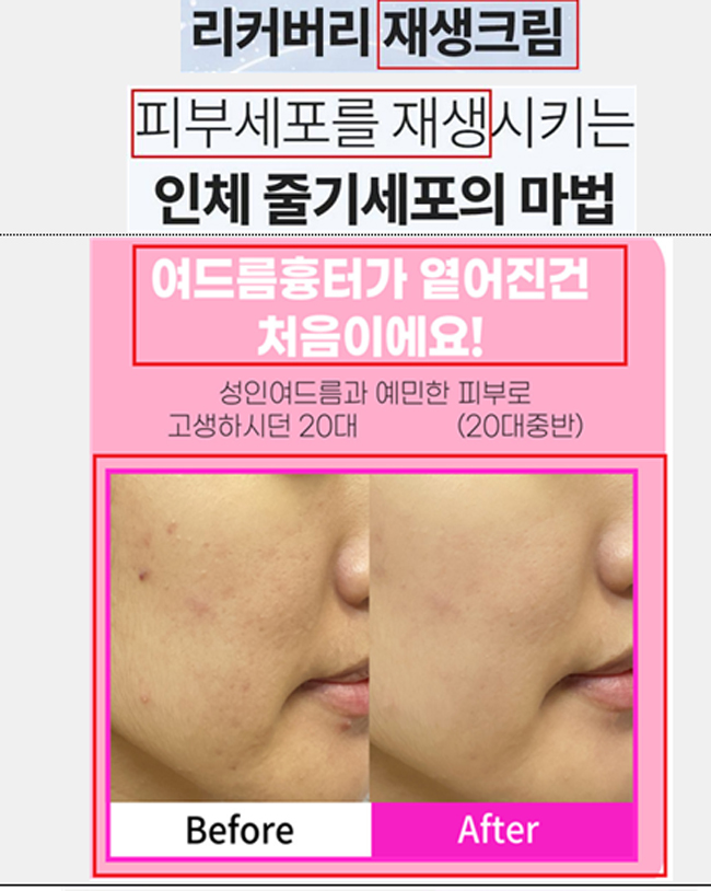 '5월 가정의 달' 의약품 등 오인 광고 주의보...226건 적발