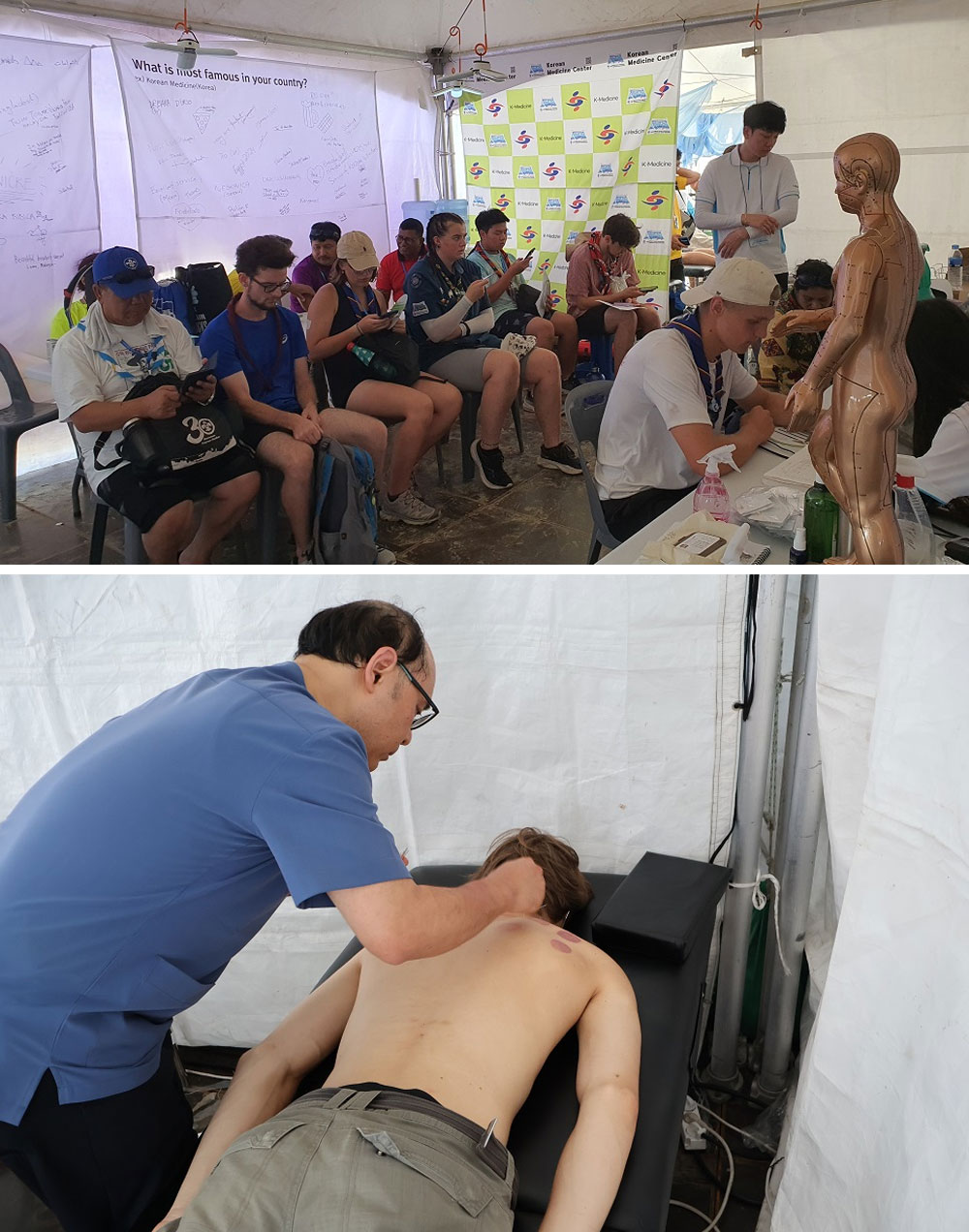 잼버리 한의사 의료봉사 각광…침, 부항 1420건 시행
