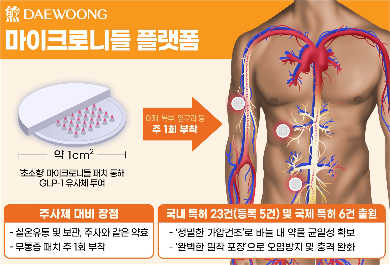 대웅제약, 붙이는 GLP-1 비만약 내년 임상 돌입