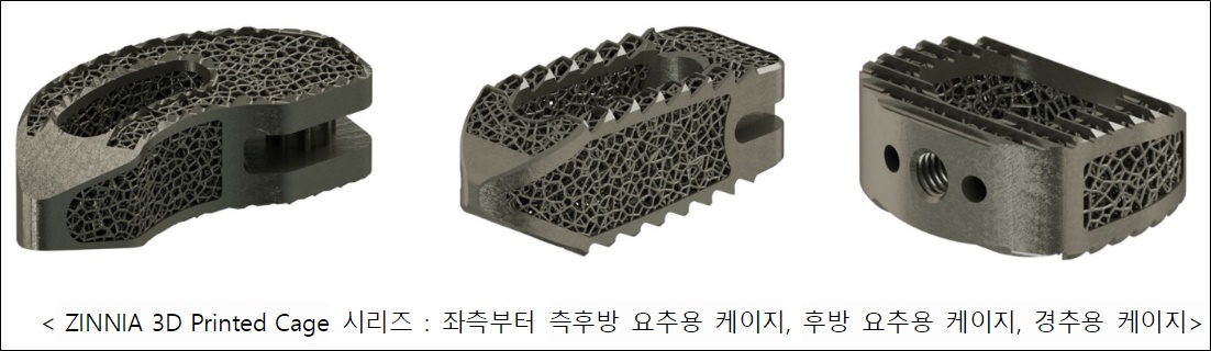 ﻿오스테오닉, 3D 프린팅 티타늄 척추 임플란트 출시