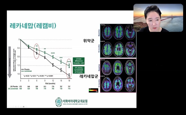 구로구약, 가을 학술 페스티벌서 '알츠하이머' 다뤄